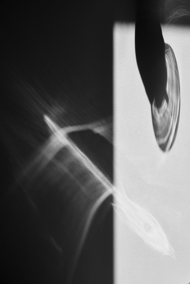 Shadow