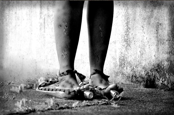 The Anxiety of Living in a War Zone