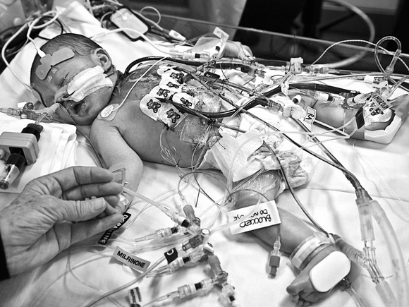 Intensive Care Intensive Care