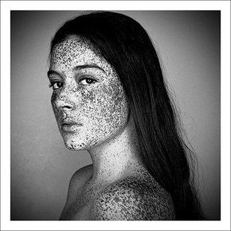 Freckles (2)