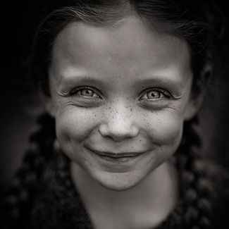 Freckles (1)
