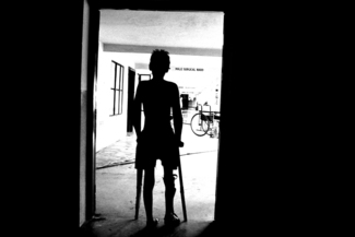 boy with leprosy