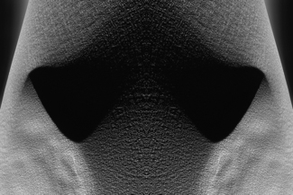 Hip (2)