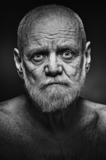 Alzheimer