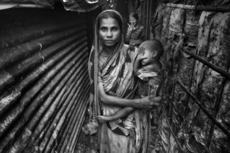 Cataract Woman