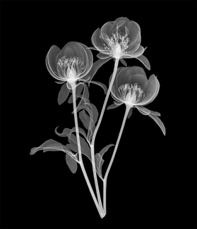 Peony Trio Xray