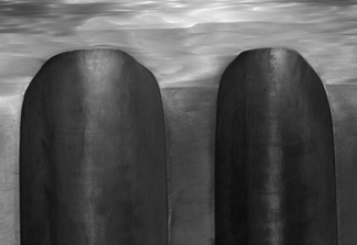 Abstract 3