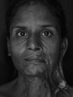 burnt women (2)