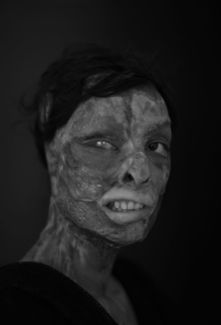 burnt women (4)