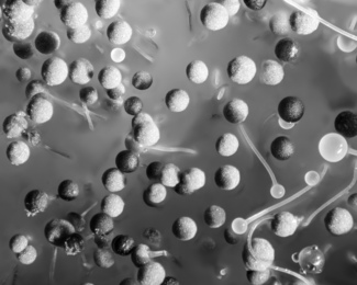 Spore Sacs on Fruit Mold