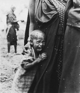 Frightened Little Girl, NDOTO, Tanzania Dream