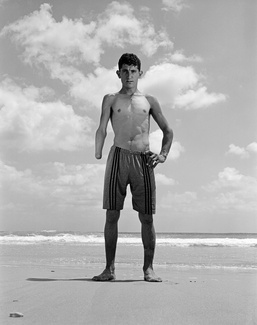 Cluster Bombs Victims-6 Cluster Bombs Victims-6