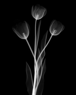 Tulips X-Ray