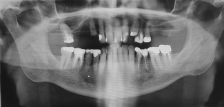 Teeth Teeth