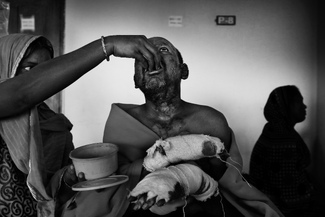 Compassion Compassion