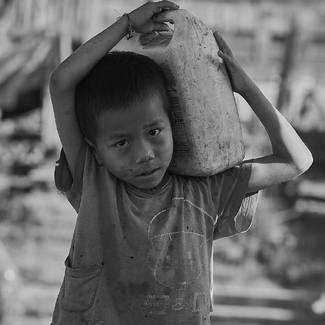 Dropy eyes Dropy eyes