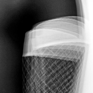 captured in the net captured in the net