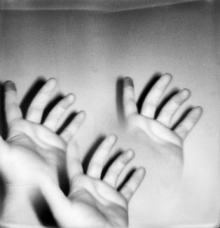 Hand of the Injured Finger Hand of the Injured Finger