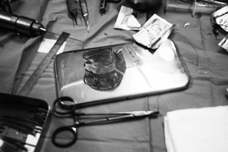 Surgery Surgery