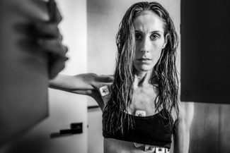 Cause Unknown Cause Unknown