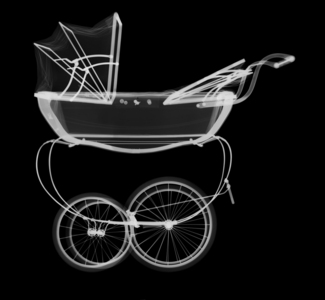 X-ray of a Pram X-ray of a Pram