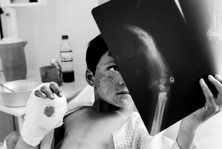 Mine Victim, Afghanistan Mine Victim, Afghanistan
